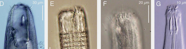 Nematode samples (c) unsplash